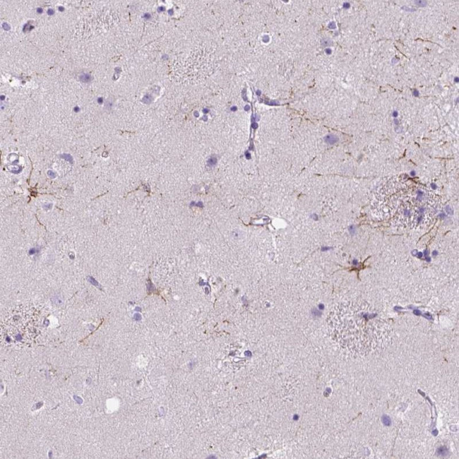 MYH15 Antibody in Immunohistochemistry (Paraffin) (IHC (P))