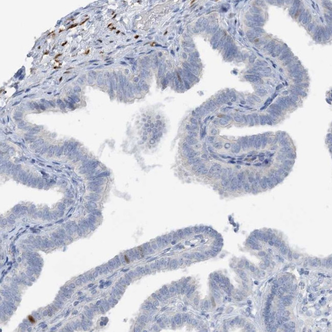ZCCHC12 Antibody in Immunohistochemistry (Paraffin) (IHC (P))