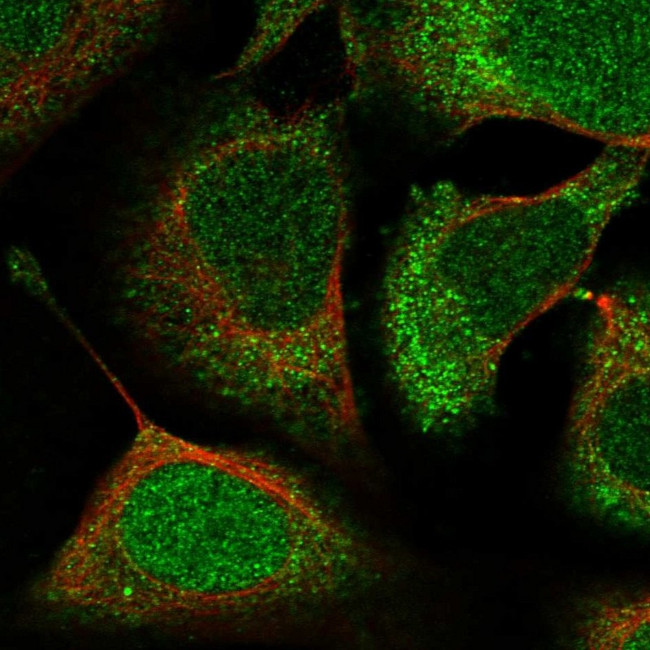 ACYP1 Antibody in Immunocytochemistry (ICC/IF)