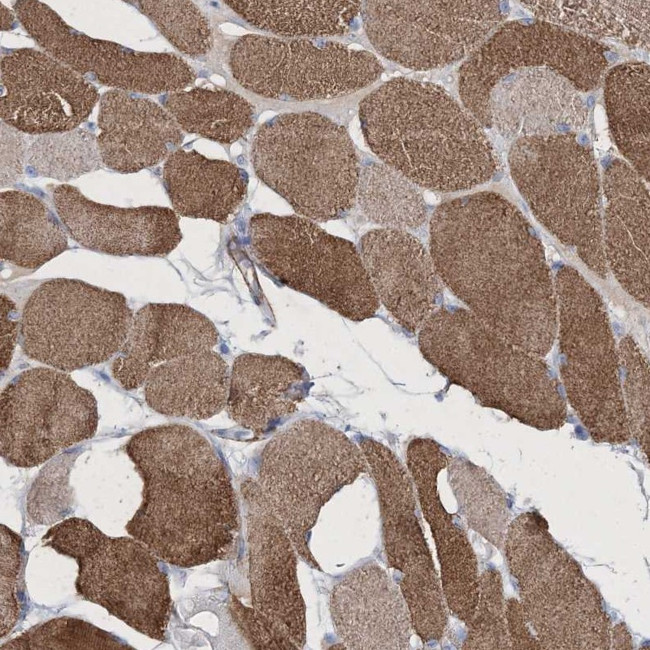 RTN2 Antibody in Immunohistochemistry (Paraffin) (IHC (P))