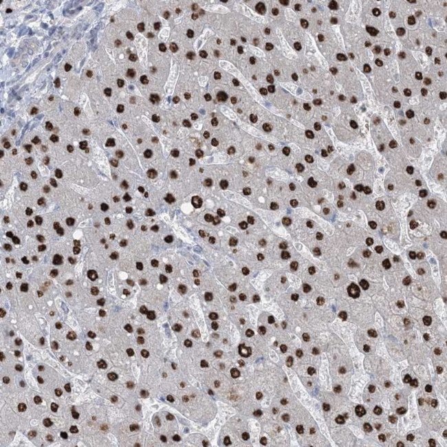 TFPT Antibody in Immunohistochemistry (Paraffin) (IHC (P))