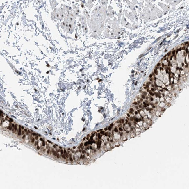SLC25A53 Antibody in Immunohistochemistry (Paraffin) (IHC (P))