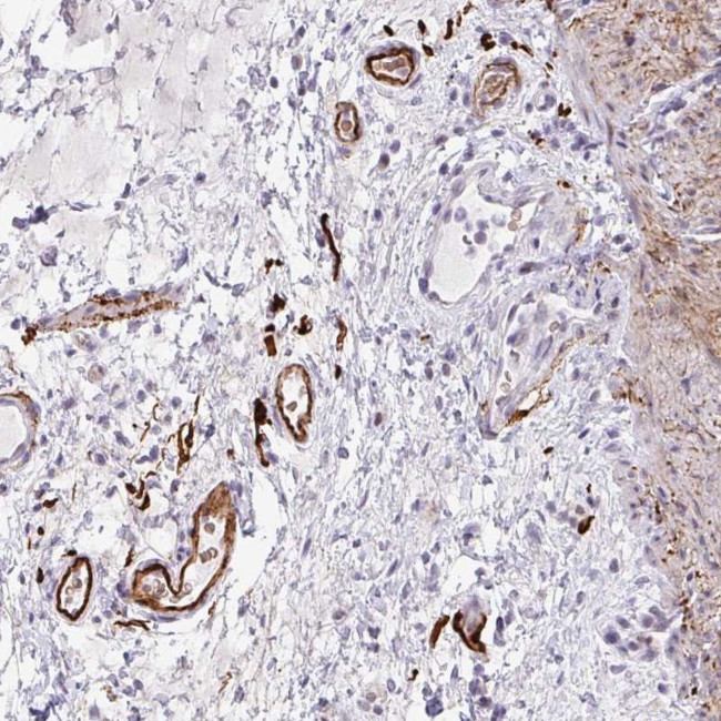 TNMD Antibody in Immunohistochemistry (IHC)