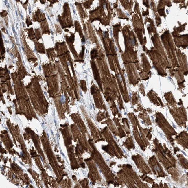 FAM26E Antibody in Immunohistochemistry (Paraffin) (IHC (P))