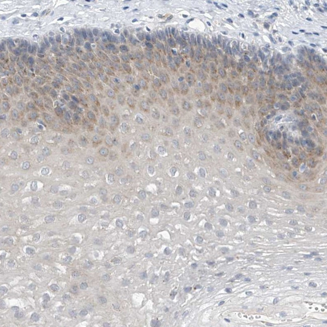 LRRC29 Antibody in Immunohistochemistry (Paraffin) (IHC (P))
