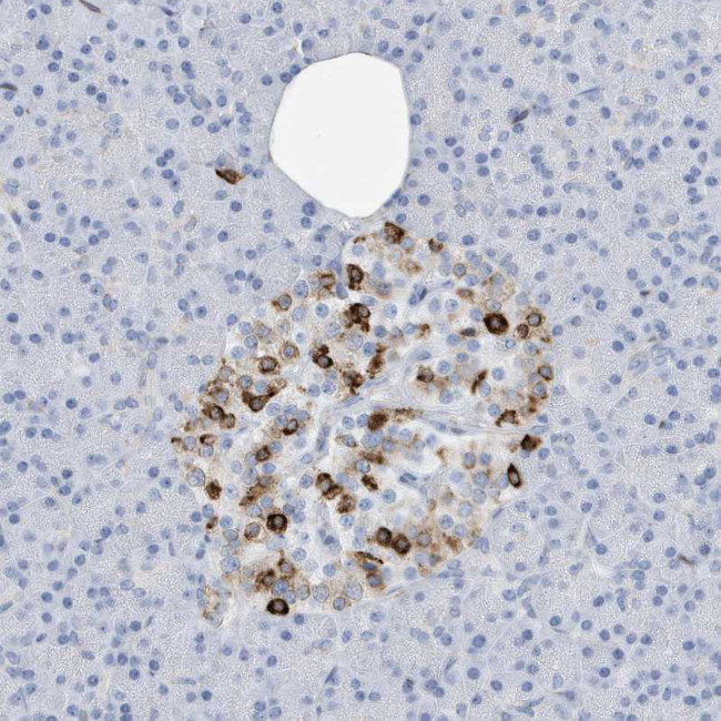 SEMA3F Antibody in Immunohistochemistry (Paraffin) (IHC (P))