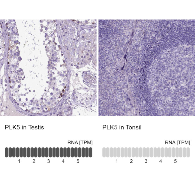 PLK5 Antibody in Immunohistochemistry (IHC)