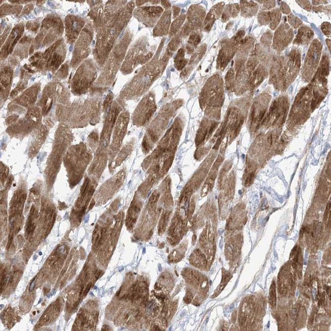 KLH18 Antibody in Immunohistochemistry (Paraffin) (IHC (P))