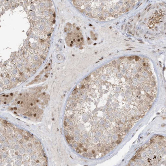 ZCWPW2 Antibody in Immunohistochemistry (Paraffin) (IHC (P))