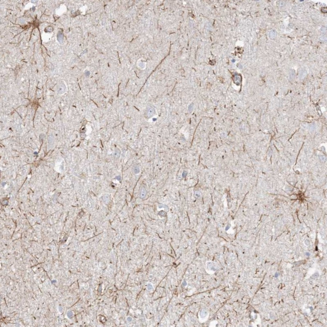 ETAA1 Antibody in Immunohistochemistry (Paraffin) (IHC (P))