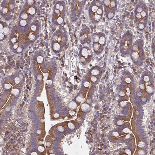 GRB14 Antibody in Immunohistochemistry (Paraffin) (IHC (P))