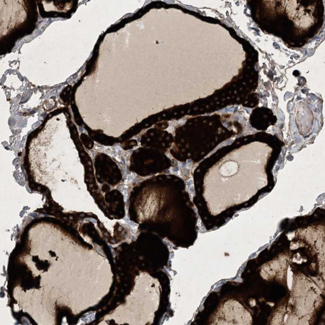 C11orf73 Antibody in Immunohistochemistry (Paraffin) (IHC (P))
