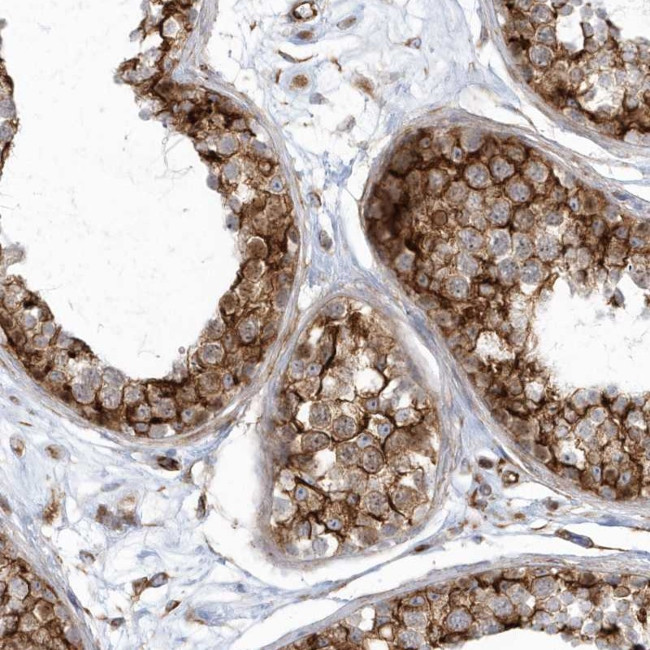 GPR152 Antibody in Immunohistochemistry (Paraffin) (IHC (P))
