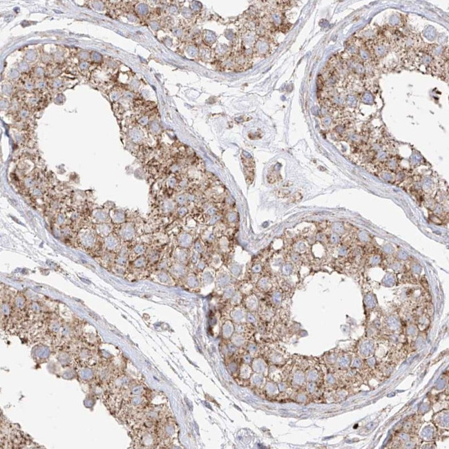 XKR3 Antibody in Immunohistochemistry (Paraffin) (IHC (P))