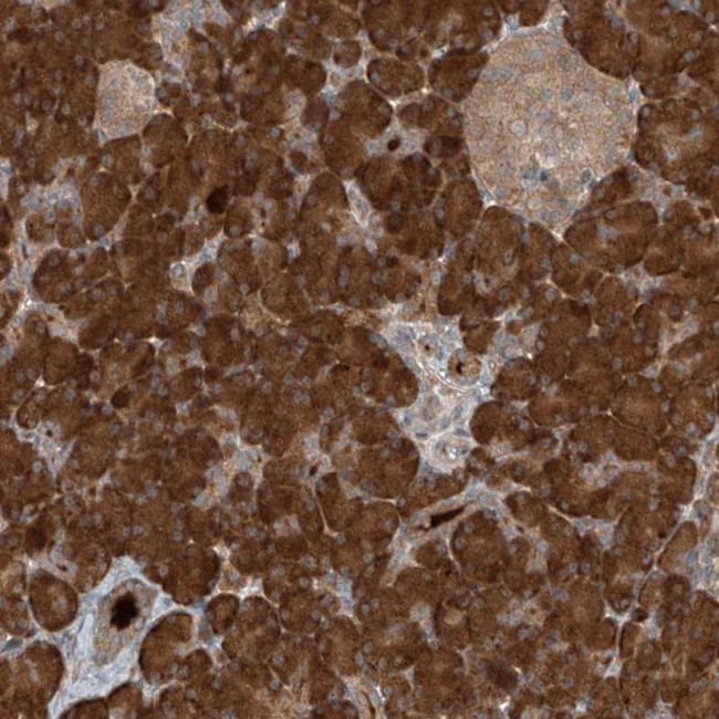 KIAA0556 Antibody in Immunohistochemistry (Paraffin) (IHC (P))