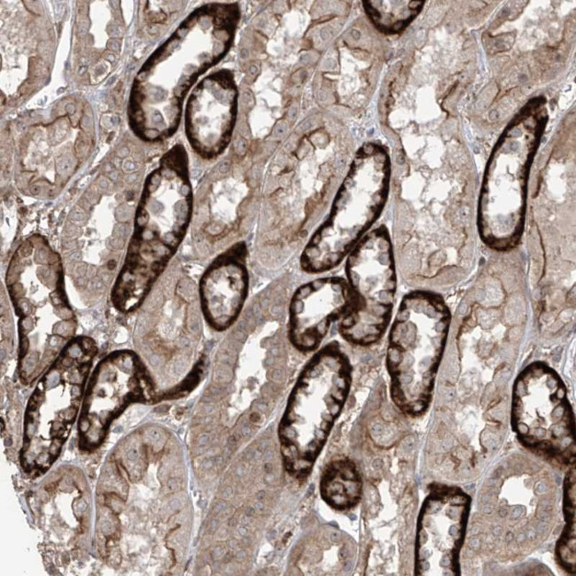 LRRC74A Antibody in Immunohistochemistry (Paraffin) (IHC (P))