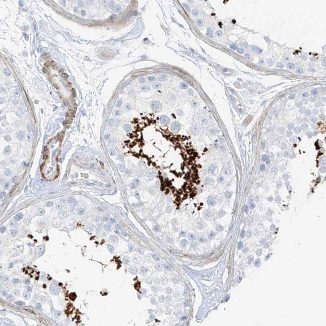 SMCP Antibody in Immunohistochemistry (Paraffin) (IHC (P))