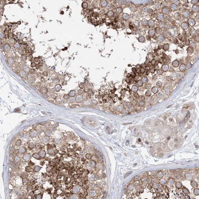 GKAP1 Antibody in Immunohistochemistry (Paraffin) (IHC (P))