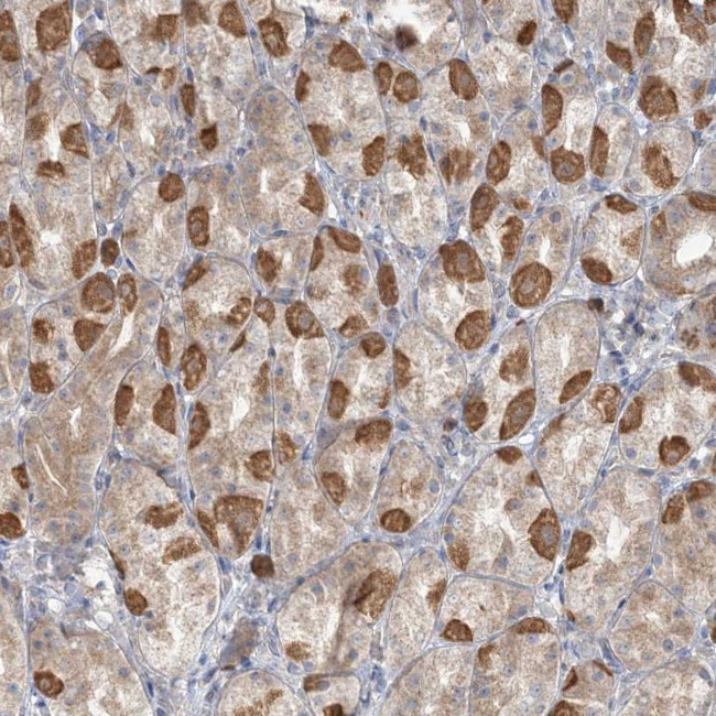 TBC1D5 Antibody in Immunohistochemistry (Paraffin) (IHC (P))