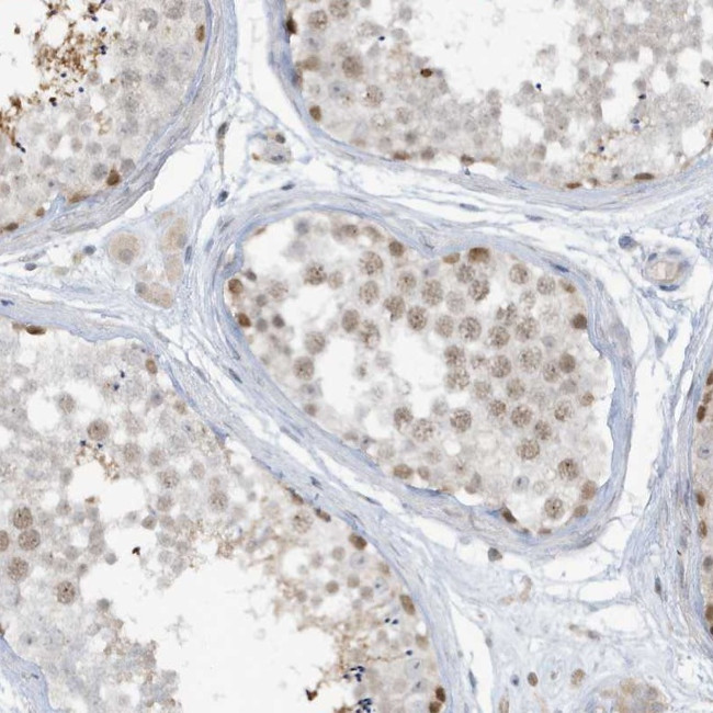 PRRT3 Antibody in Immunohistochemistry (Paraffin) (IHC (P))