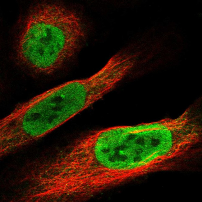 FAM9B Antibody in Immunocytochemistry (ICC/IF)