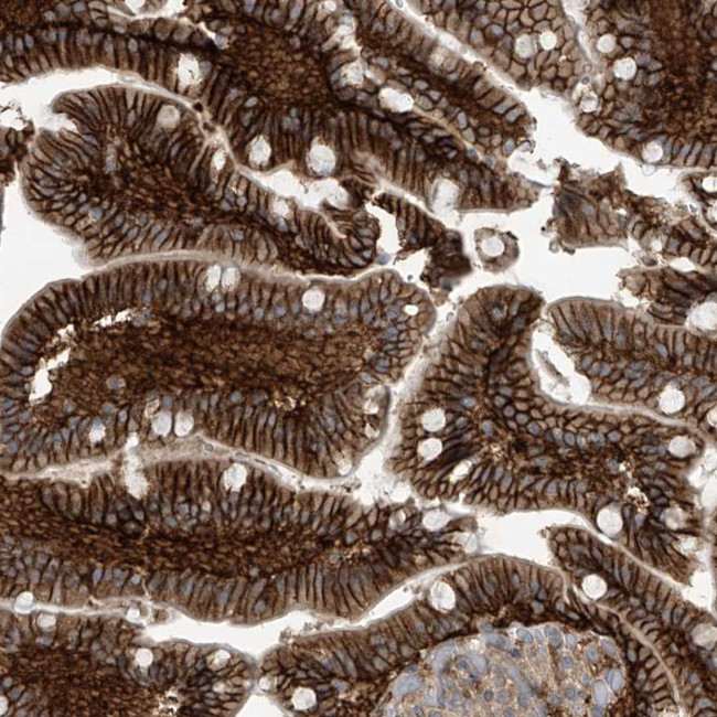 FSD1L Antibody in Immunohistochemistry (Paraffin) (IHC (P))