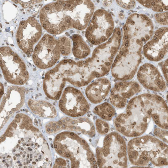 RABL3 Antibody in Immunohistochemistry (Paraffin) (IHC (P))