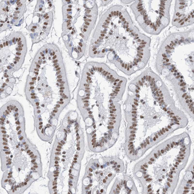 ZNF792 Antibody in Immunohistochemistry (Paraffin) (IHC (P))