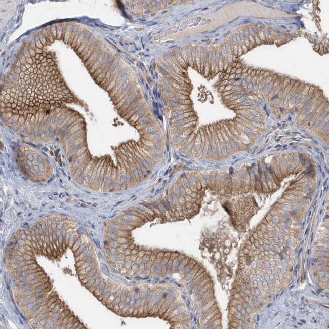 RAB17 Antibody in Immunohistochemistry (Paraffin) (IHC (P))