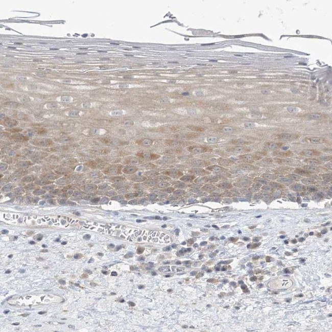 THADA Antibody in Immunohistochemistry (IHC)