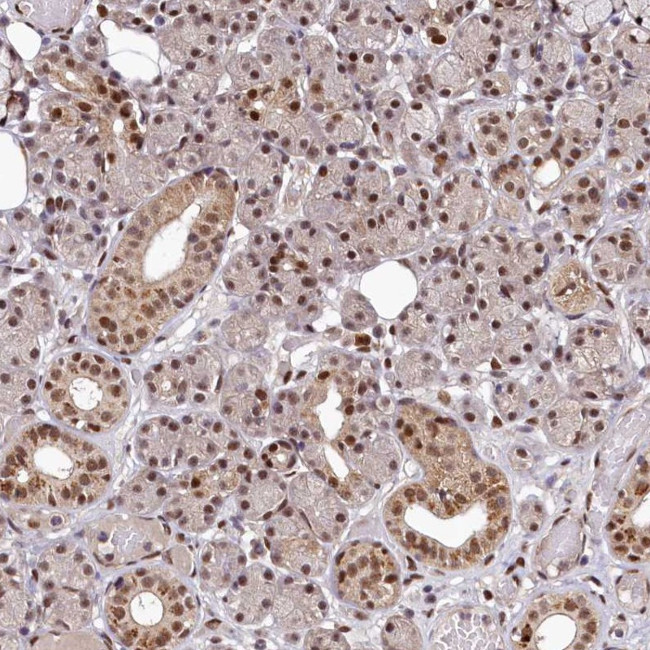 MAML2 Antibody in Immunohistochemistry (Paraffin) (IHC (P))