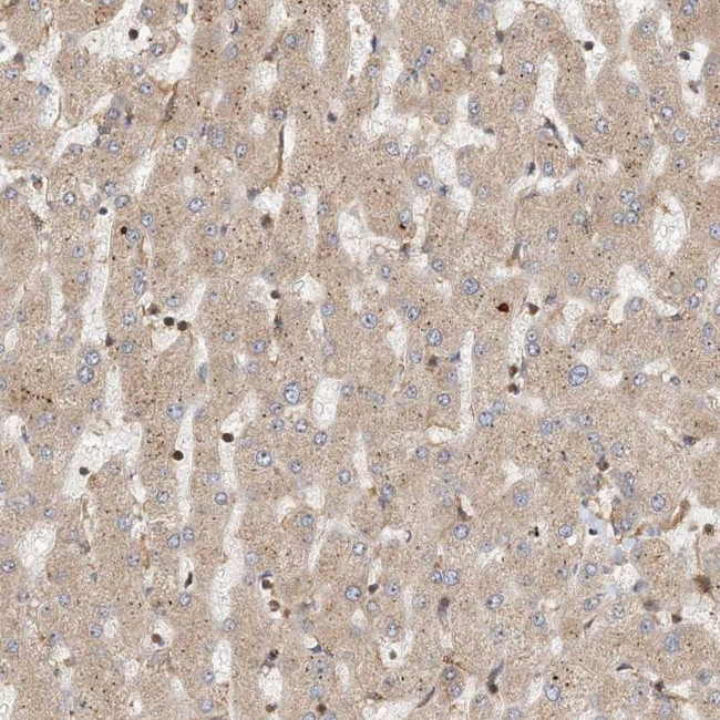 COLEC11 Antibody in Immunohistochemistry (IHC)