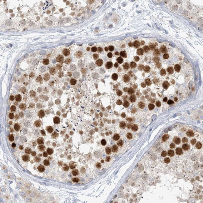 SCML1 Antibody in Immunohistochemistry (Paraffin) (IHC (P))