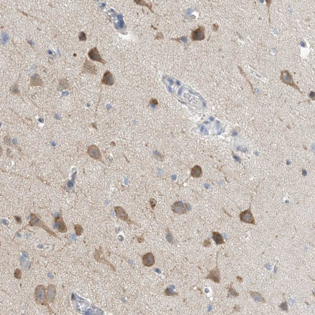 CCDC14 Antibody in Immunohistochemistry (Paraffin) (IHC (P))