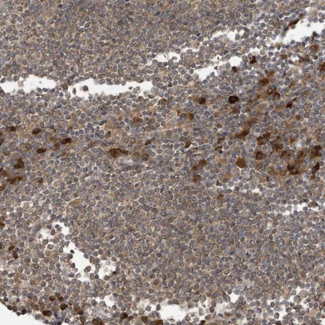 STX10 Antibody in Immunohistochemistry (IHC)