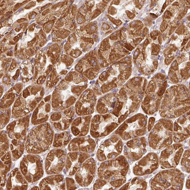EFHC1 Antibody in Immunohistochemistry (Paraffin) (IHC (P))