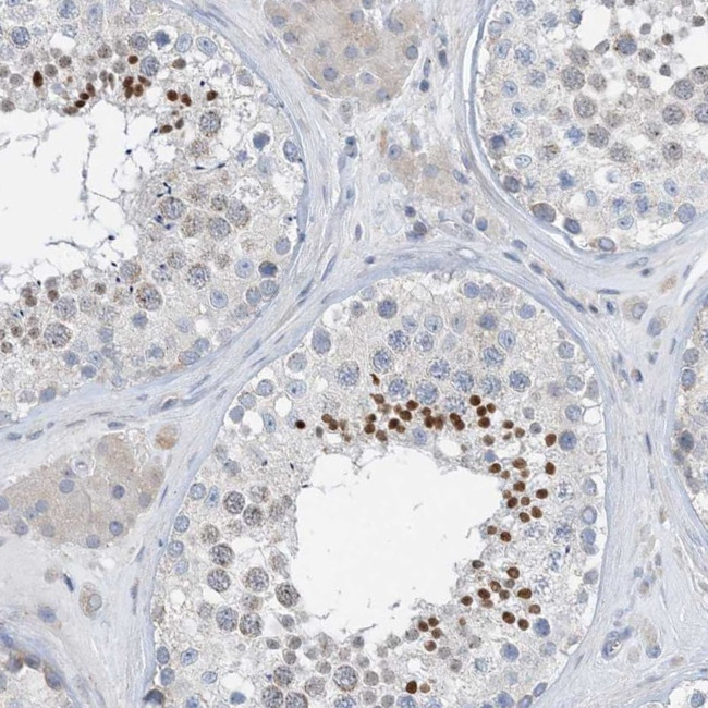 BTBD8 Antibody in Immunohistochemistry (IHC)