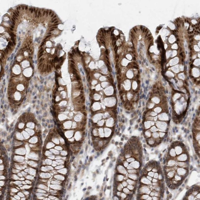MXI1 Antibody in Immunohistochemistry (IHC)