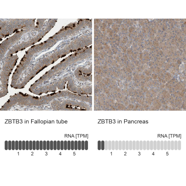 ZBTB3 Antibody in Immunohistochemistry (IHC)
