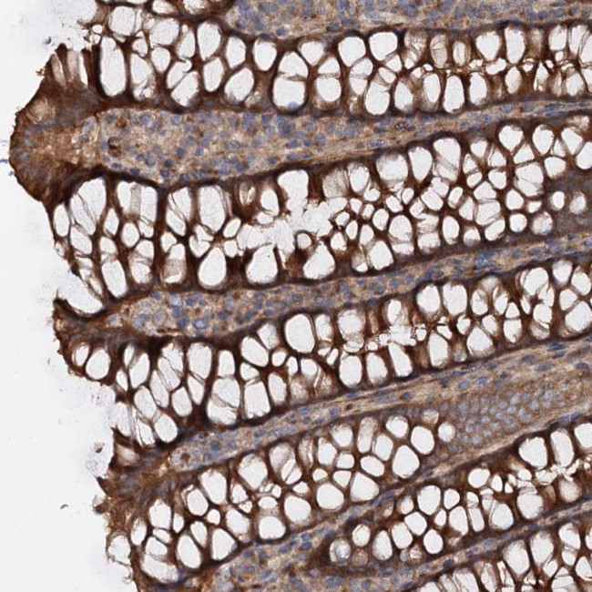 GPR112 Antibody in Immunohistochemistry (Paraffin) (IHC (P))