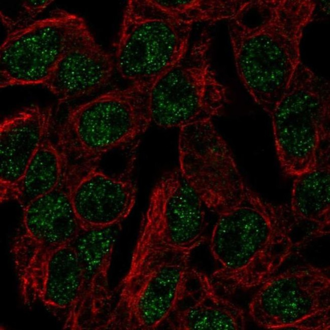 SLC5A11 Antibody in Immunocytochemistry (ICC/IF)