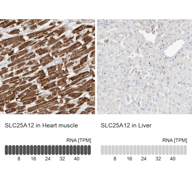 SLC25A12 Antibody in Immunohistochemistry (IHC)