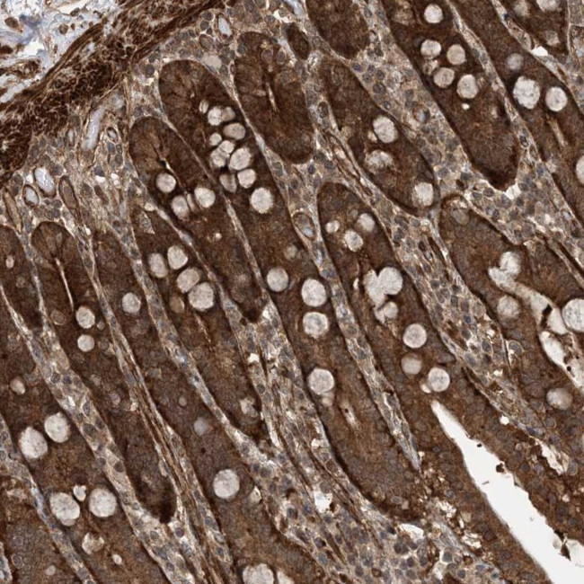 ZNF511 Antibody in Immunohistochemistry (Paraffin) (IHC (P))