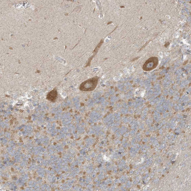 proCNP Antibody in Immunohistochemistry (IHC)