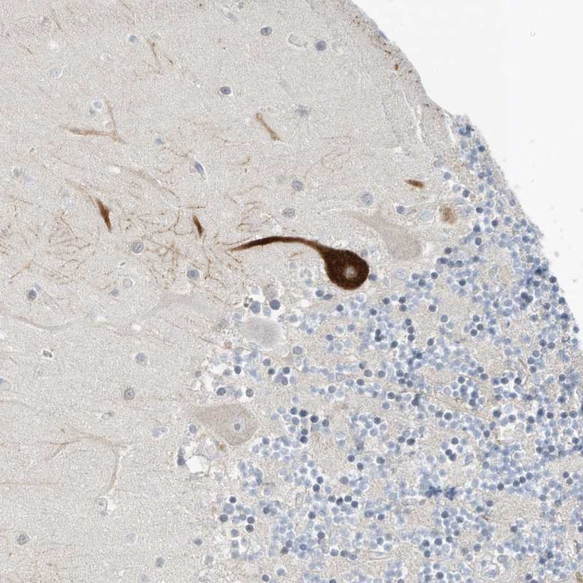 RASA2 Antibody in Immunohistochemistry (Paraffin) (IHC (P))