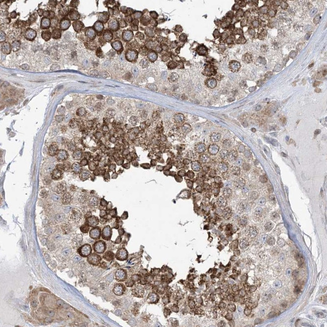 SOGA3 Antibody in Immunohistochemistry (Paraffin) (IHC (P))