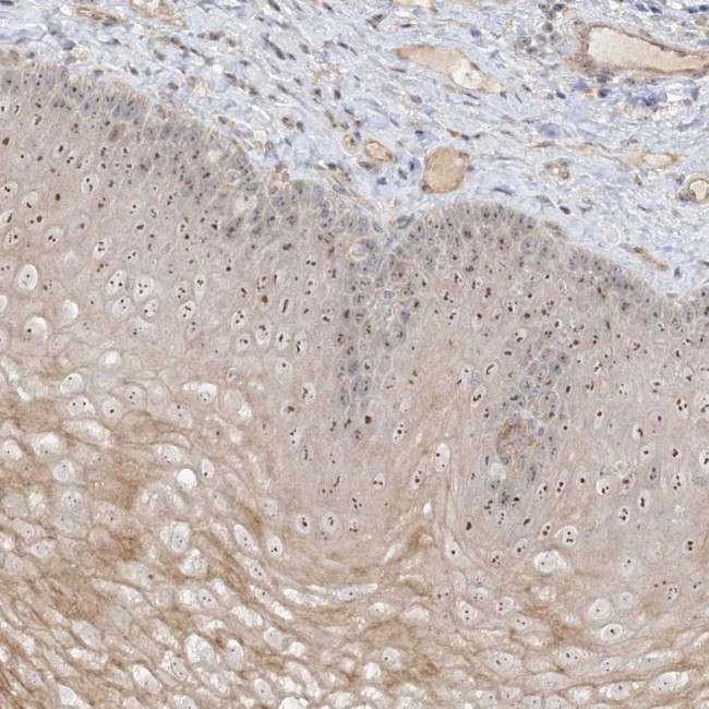 DDX18 Antibody in Immunohistochemistry (Paraffin) (IHC (P))
