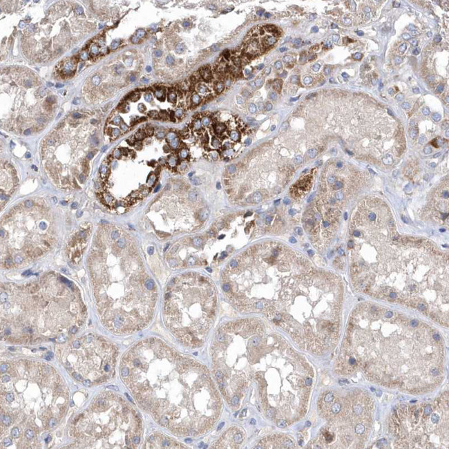METTL8 Antibody in Immunohistochemistry (Paraffin) (IHC (P))