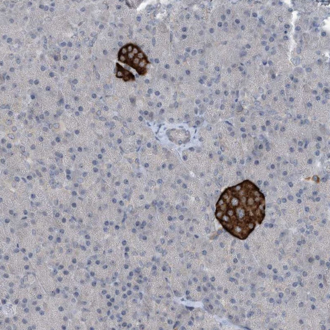 TINAG Antibody in Immunohistochemistry (Paraffin) (IHC (P))