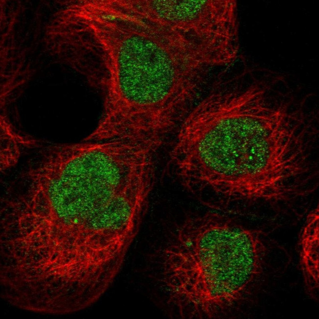 PCYT1A Antibody in Immunocytochemistry (ICC/IF)